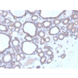 Immunohistochemistry - Anti-DBC2 Antibody [DBC2/3364] - BSA and Azide free (A251755) - Antibodies.com