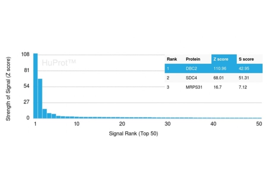 Protein Array - Anti-DBC2 Antibody [DBC2/3364] - BSA and Azide free (A251754) - Antibodies.com