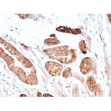 Immunohistochemistry - Anti-FLT3 Antibody [FLT3/2458] - BSA and Azide free (A251755) - Antibodies.com