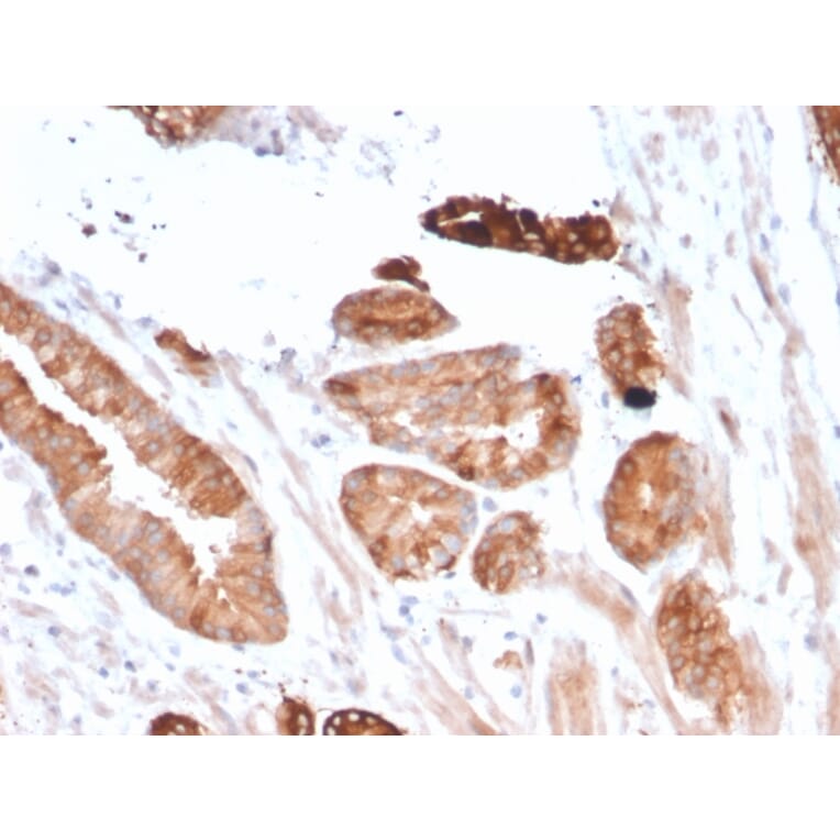 Immunohistochemistry - Anti-FLT3 Antibody [FLT3/2458] - BSA and Azide free (A251755) - Antibodies.com