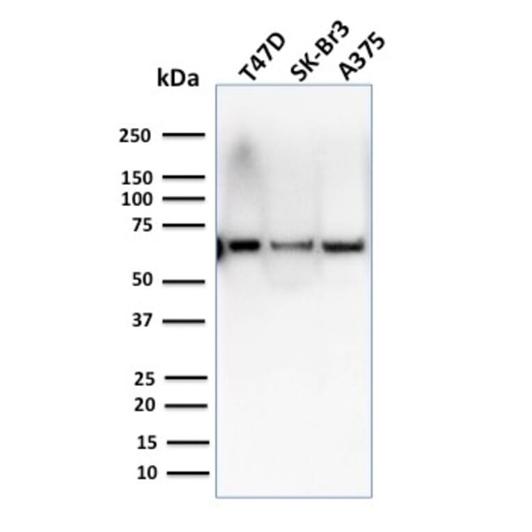 Western Blot - Anti-CSTF2T Antibody [PCRP-CSTF2T-1A3] - BSA and Azide free (A251757) - Antibodies.com