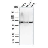 Western Blot - Anti-CSTF2T Antibody [PCRP-CSTF2T-1A3] - BSA and Azide free (A251757) - Antibodies.com