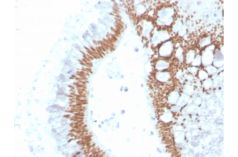 Immunohistochemistry - Anti-SATB2 Antibody [SATB2/4374R] - BSA and Azide free (A251759) - Antibodies.com