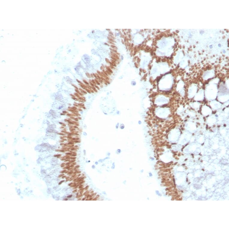 Immunohistochemistry - Anti-SATB2 Antibody [SATB2/4374R] - BSA and Azide free (A251759) - Antibodies.com