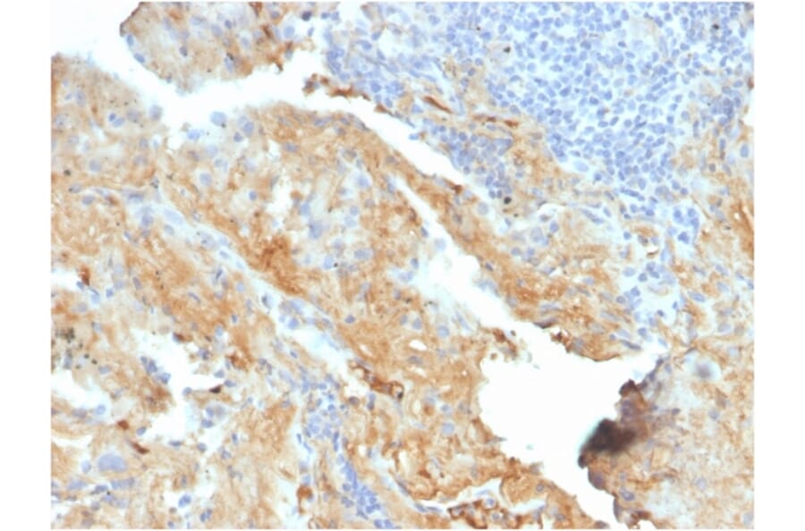 Immunohistochemistry - Anti-Fibronectin Antibody [FN1/2950] - BSA and Azide free (A251761) - Antibodies.com