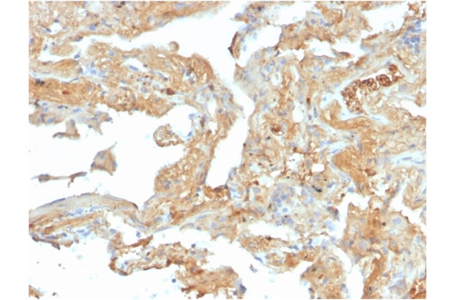 Immunohistochemistry - Anti-Fibronectin Antibody [FN1/2950] - BSA and Azide free (A251761) - Antibodies.com