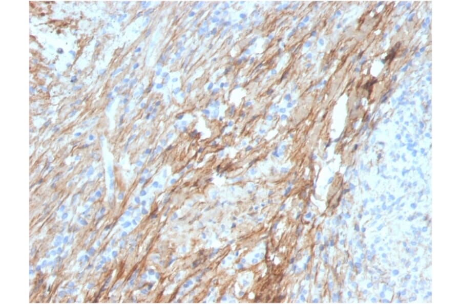 Immunohistochemistry - Anti-Fibronectin Antibody [FN1/3029] - BSA and Azide free (A251762) - Antibodies.com
