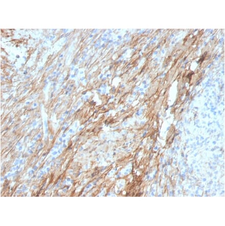 Immunohistochemistry - Anti-Fibronectin Antibody [FN1/3029] - BSA and Azide free (A251762) - Antibodies.com