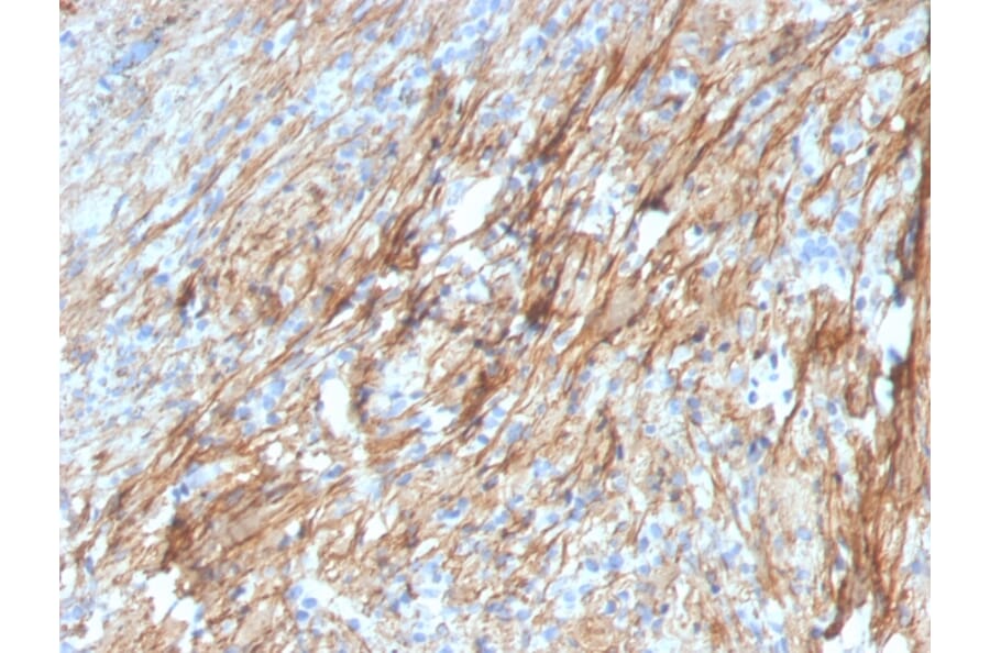 Immunohistochemistry - Anti-Fibronectin Antibody [FN1/3029] - BSA and Azide free (A251762) - Antibodies.com
