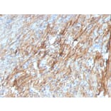 Immunohistochemistry - Anti-Fibronectin Antibody [FN1/3029] - BSA and Azide free (A251762) - Antibodies.com