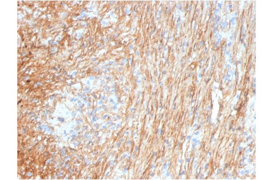 Immunohistochemistry - Anti-Fibronectin Antibody [FN1/3036] - BSA and Azide free (A251763) - Antibodies.com