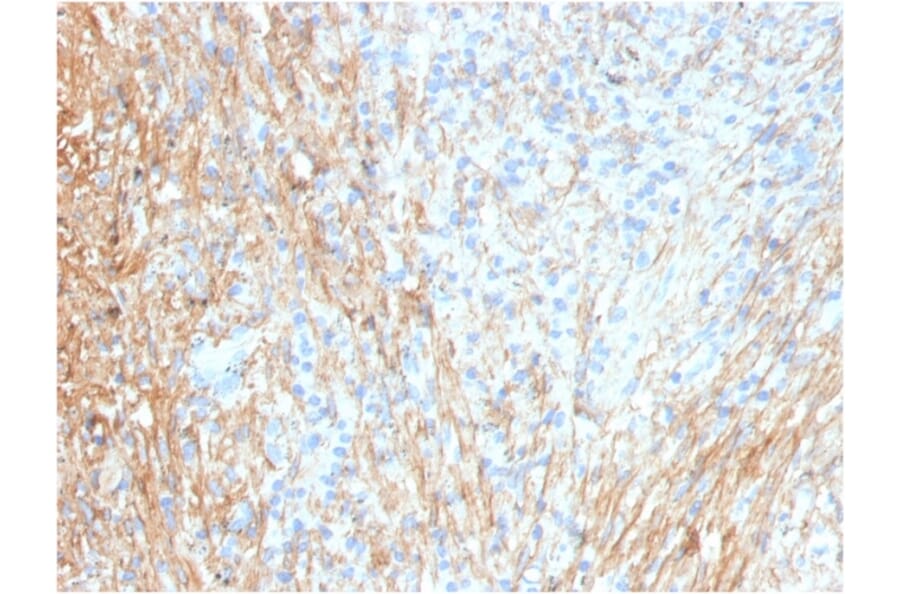 Immunohistochemistry - Anti-Fibronectin Antibody [FN1/3036] - BSA and Azide free (A251763) - Antibodies.com