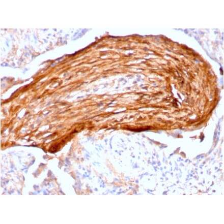 Immunohistochemistry - Anti-Fibronectin Antibody [FN1/3045] - BSA and Azide free (A251764) - Antibodies.com