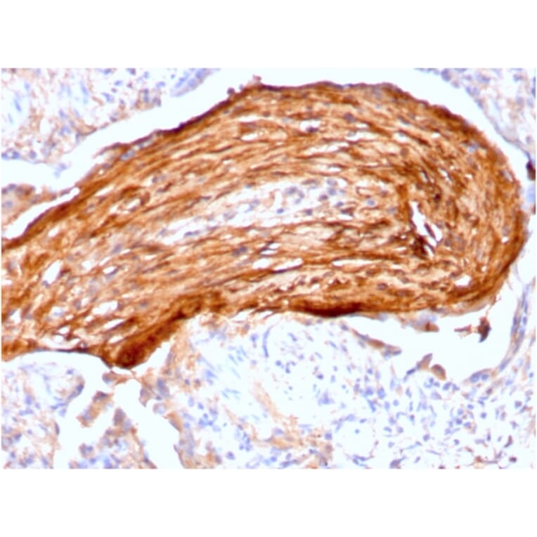 Immunohistochemistry - Anti-Fibronectin Antibody [FN1/3045] - BSA and Azide free (A251764) - Antibodies.com