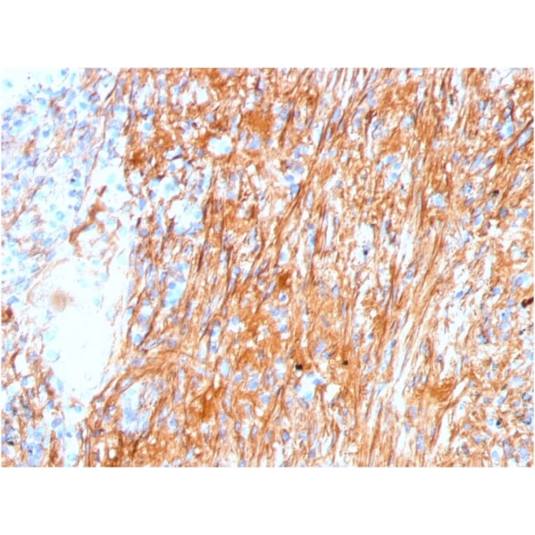 Immunohistochemistry - Anti-Fibronectin Antibody [FN1/3045] - BSA and Azide free (A251764) - Antibodies.com