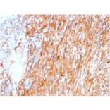 Immunohistochemistry - Anti-Fibronectin Antibody [FN1/3045] - BSA and Azide free (A251764) - Antibodies.com