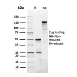 SDS-PAGE - Anti-Fibronectin Antibody [FN1/3045] - BSA and Azide free (A251764) - Antibodies.com