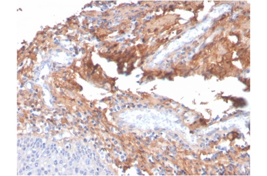 Immunohistochemistry - Anti-Fibronectin Antibody [C6F10] - BSA and Azide free (A251765) - Antibodies.com