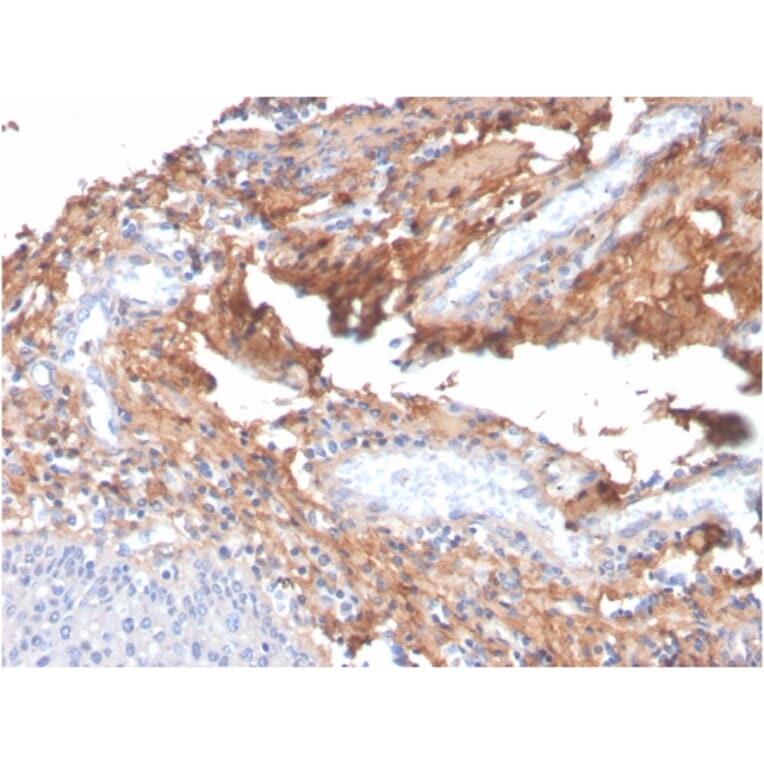 Immunohistochemistry - Anti-Fibronectin Antibody [C6F10] - BSA and Azide free (A251765) - Antibodies.com