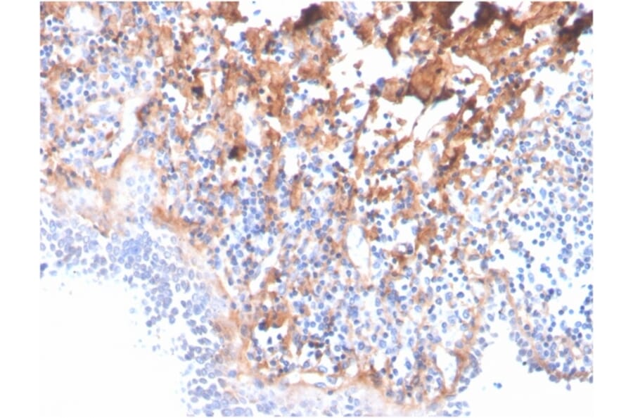 Immunohistochemistry - Anti-Fibronectin Antibody [C6F10] - BSA and Azide free (A251764) - Antibodies.com