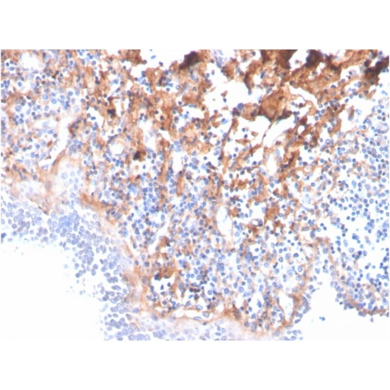Immunohistochemistry - Anti-Fibronectin Antibody [C6F10] - BSA and Azide free (A251764) - Antibodies.com