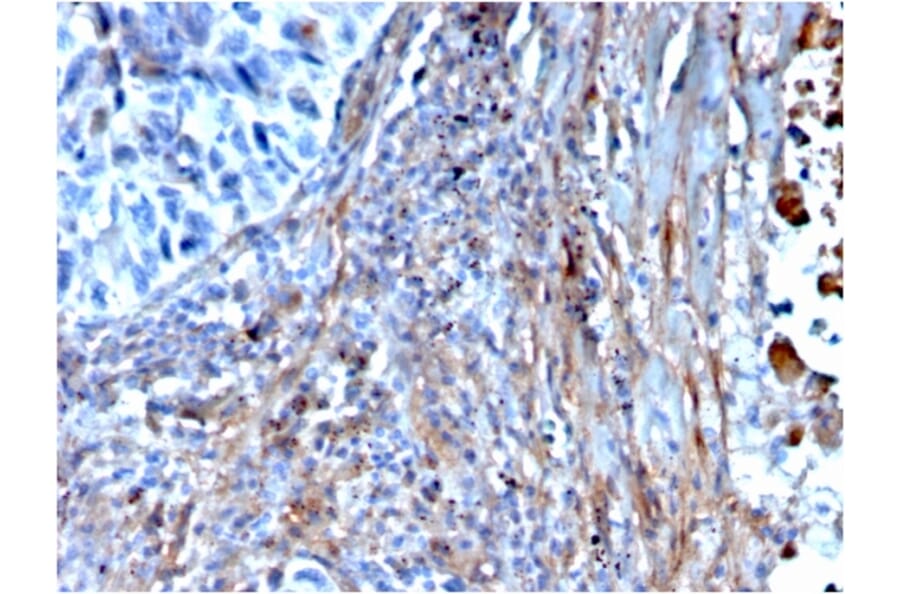 Immunohistochemistry - Anti-Fibronectin Antibody [FN1/3568] - BSA and Azide free (A251766) - Antibodies.com