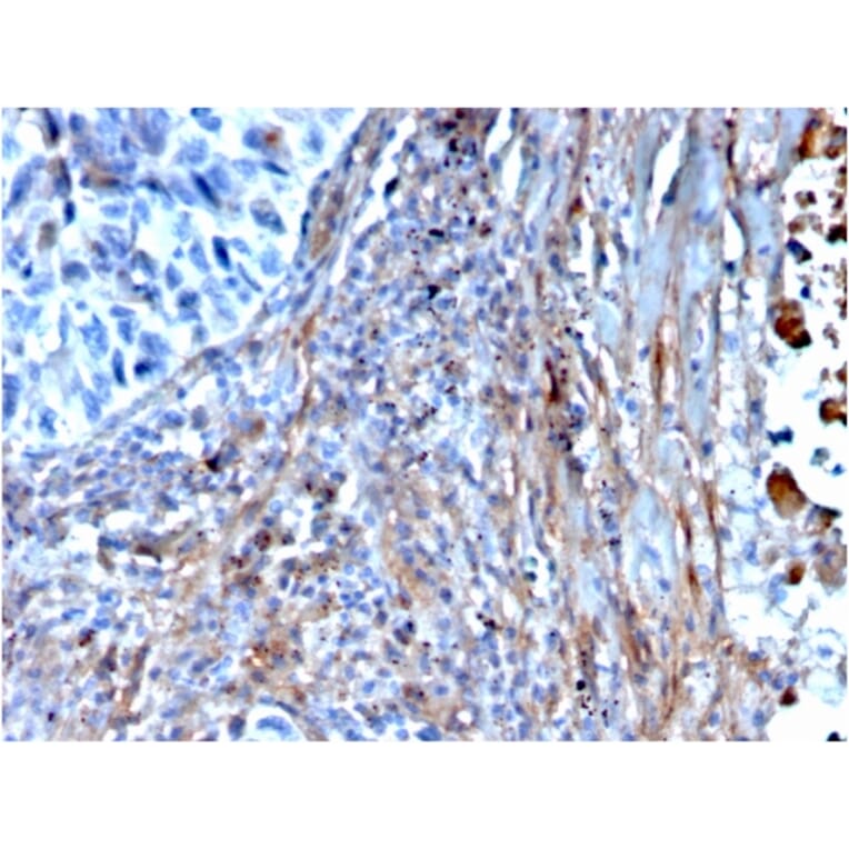 Immunohistochemistry - Anti-Fibronectin Antibody [FN1/3568] - BSA and Azide free (A251766) - Antibodies.com