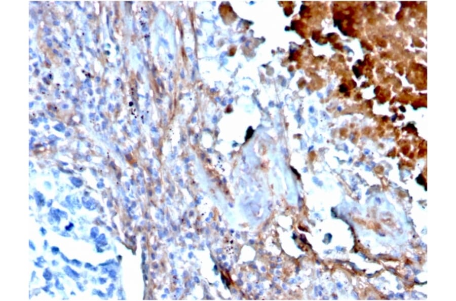 Immunohistochemistry - Anti-Fibronectin Antibody [FN1/3568] - BSA and Azide free (A251766) - Antibodies.com