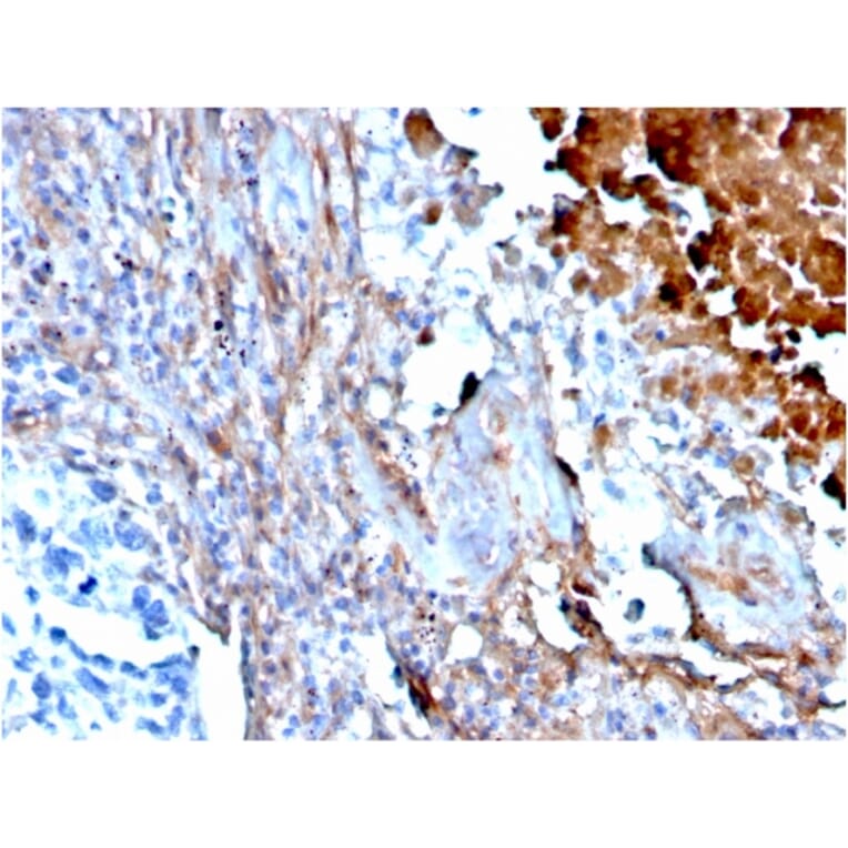 Immunohistochemistry - Anti-Fibronectin Antibody [FN1/3568] - BSA and Azide free (A251766) - Antibodies.com