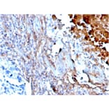 Immunohistochemistry - Anti-Fibronectin Antibody [FN1/3568] - BSA and Azide free (A251766) - Antibodies.com