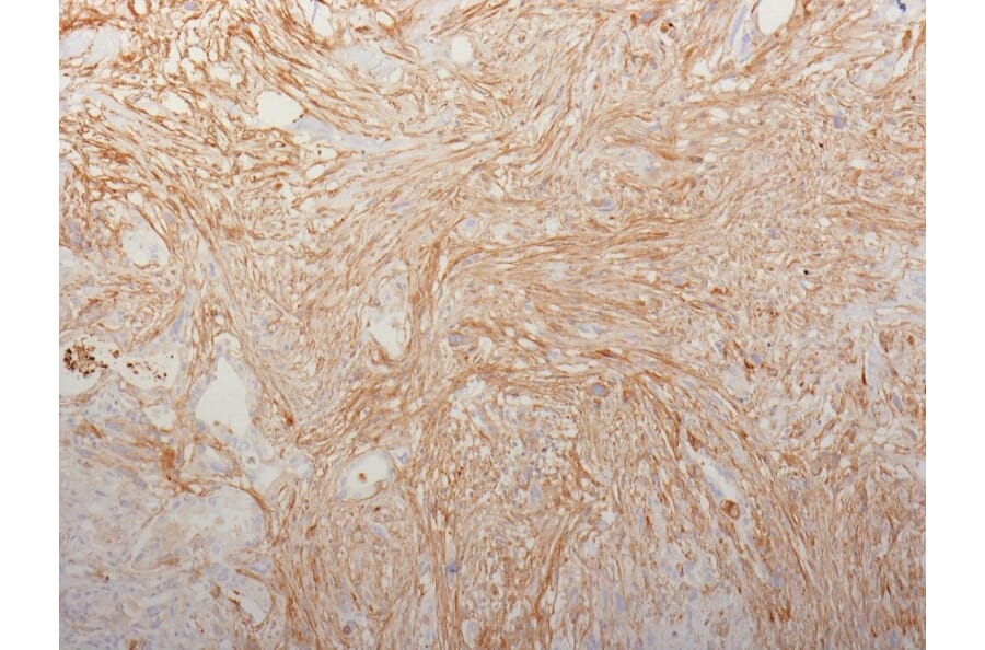 Immunohistochemistry - Anti-Fibronectin Antibody [HFN7.1] - BSA and Azide free (A251766) - Antibodies.com