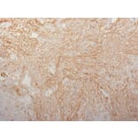 Immunohistochemistry - Anti-Fibronectin Antibody [HFN7.1] - BSA and Azide free (A251766) - Antibodies.com