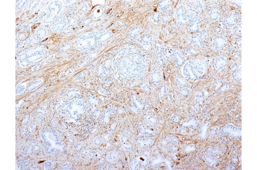 Immunohistochemistry - Anti-Fibronectin Antibody [SPM539] - BSA and Azide free (A251767) - Antibodies.com