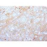 Immunohistochemistry - Anti-Fibronectin Antibody [SPM539] - BSA and Azide free (A251767) - Antibodies.com
