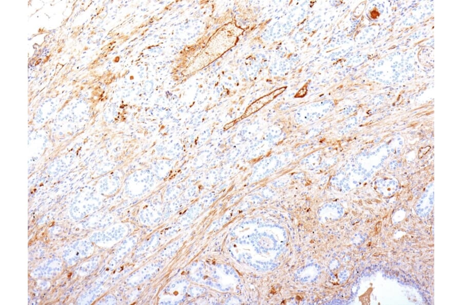 Immunohistochemistry - Anti-Fibronectin Antibody [SPM246] - BSA and Azide free (A251769) - Antibodies.com