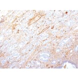 Immunohistochemistry - Anti-Fibronectin Antibody [SPM246] - BSA and Azide free (A251769) - Antibodies.com