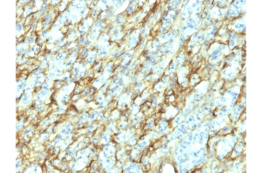 Immunohistochemistry - Anti-Fibronectin Antibody [568] - BSA and Azide free (A251770) - Antibodies.com