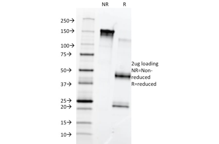 SDS-PAGE - Anti-Fibronectin Antibody [568] - BSA and Azide free (A251771) - Antibodies.com