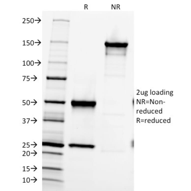 SDS-PAGE - Anti-Fibronectin Antibody [616] - BSA and Azide free (A251772) - Antibodies.com