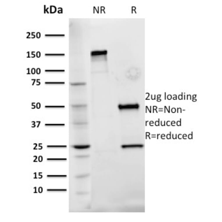 SDS-PAGE - Anti-Fibronectin Antibody [Fn-3] - BSA and Azide free (A251772) - Antibodies.com