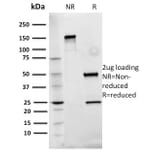 SDS-PAGE - Anti-Fibronectin Antibody [Fn-3] - BSA and Azide free (A251772) - Antibodies.com