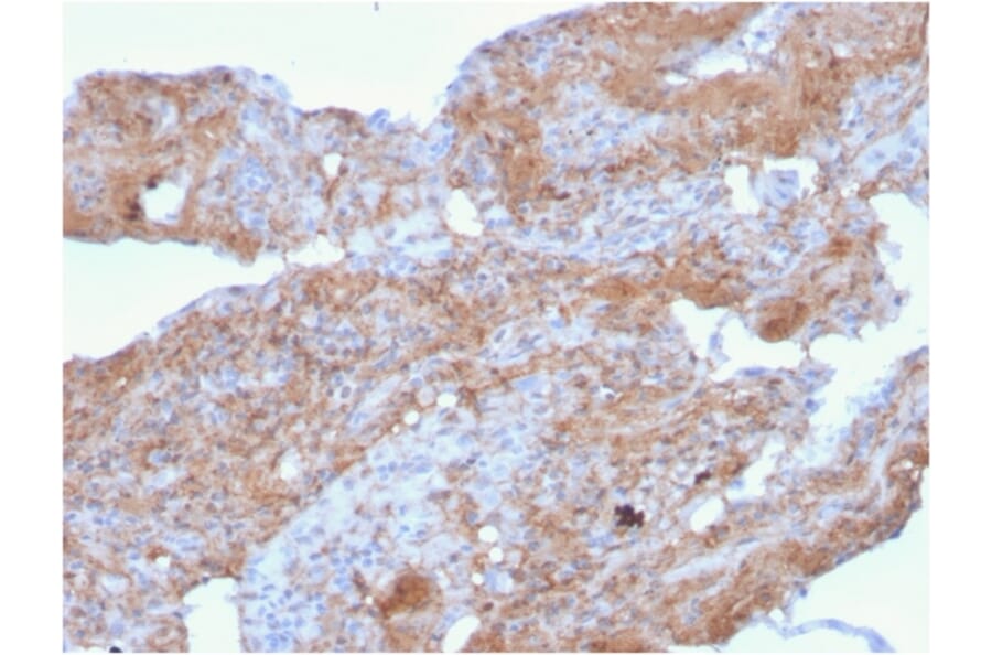 Immunohistochemistry - Anti-Fibronectin Antibody [FN1/2948] - BSA and Azide free (A251774) - Antibodies.com