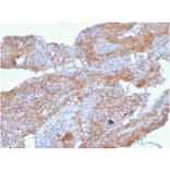 Immunohistochemistry - Anti-Fibronectin Antibody [FN1/2948] - BSA and Azide free (A251774) - Antibodies.com