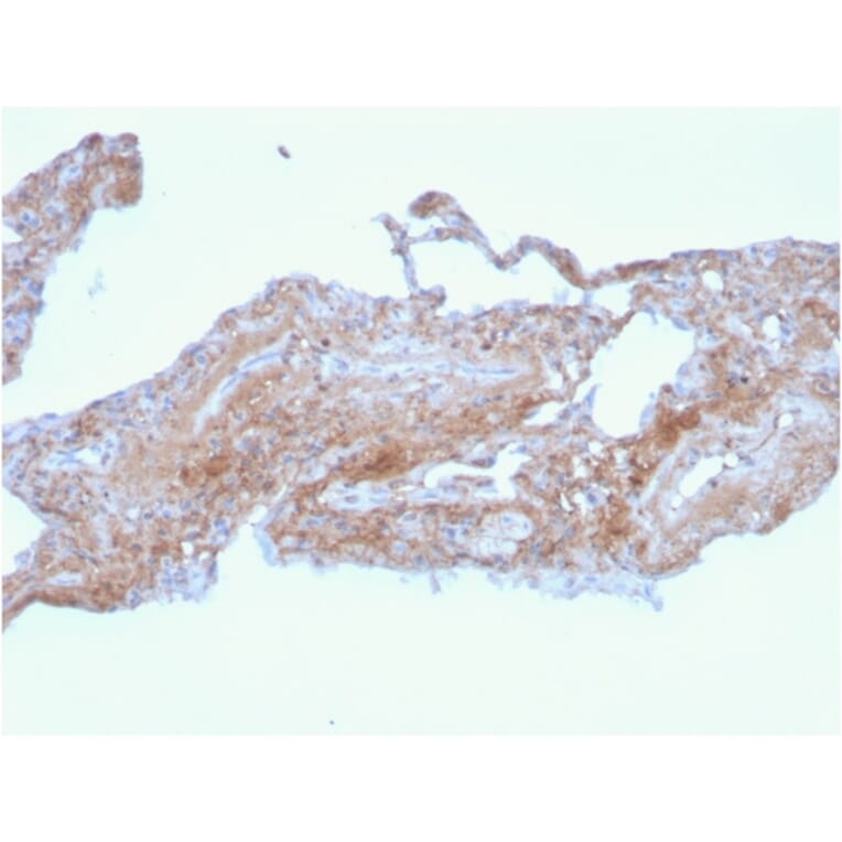 Immunohistochemistry - Anti-Fibronectin Antibody [FN1/2948] - BSA and Azide free (A251774) - Antibodies.com