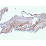 Immunohistochemistry - Anti-Fibronectin Antibody [FN1/2948] - BSA and Azide free (A251774) - Antibodies.com