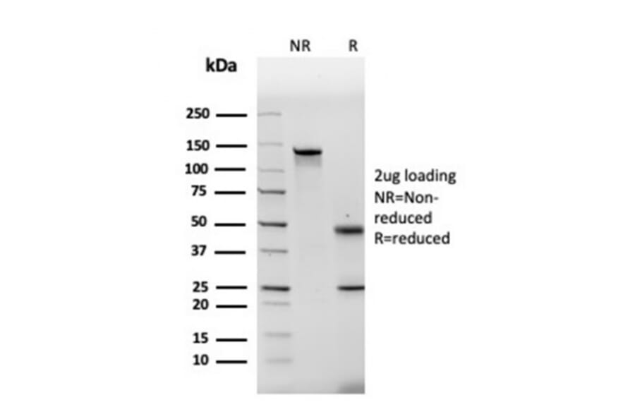 SDS-PAGE - Anti-Fibronectin Antibody [FN1/2948] - BSA and Azide free (A251774) - Antibodies.com