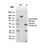 SDS-PAGE - Anti-Fibronectin Antibody [FN1/2948] - BSA and Azide free (A251774) - Antibodies.com