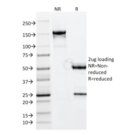 SDS-PAGE - Anti-CELA3B Antibody [CELA3B/1811] - BSA and Azide free (A251775) - Antibodies.com