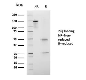 SDS-PAGE - Anti-CELA3B Antibody [rCELA3B/1811] - BSA and Azide free (A251777) - Antibodies.com