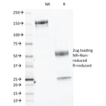 SDS-PAGE - Anti-CELA3B Antibody [CELA3B/1218] - BSA and Azide free (A251777) - Antibodies.com